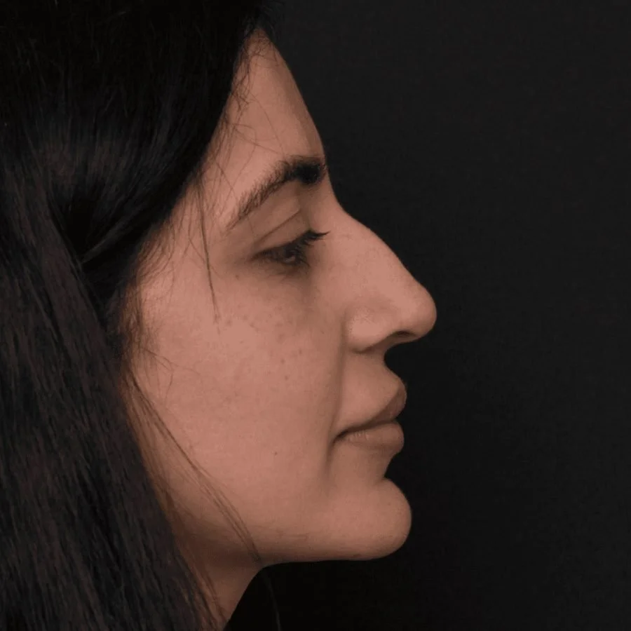 samia-before-left.jpg
