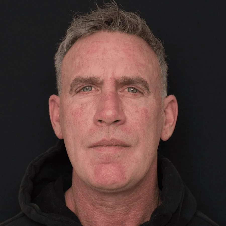 alan-before-front.jpg