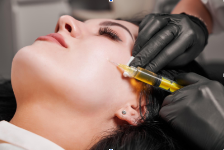 PRP Facial Treatment