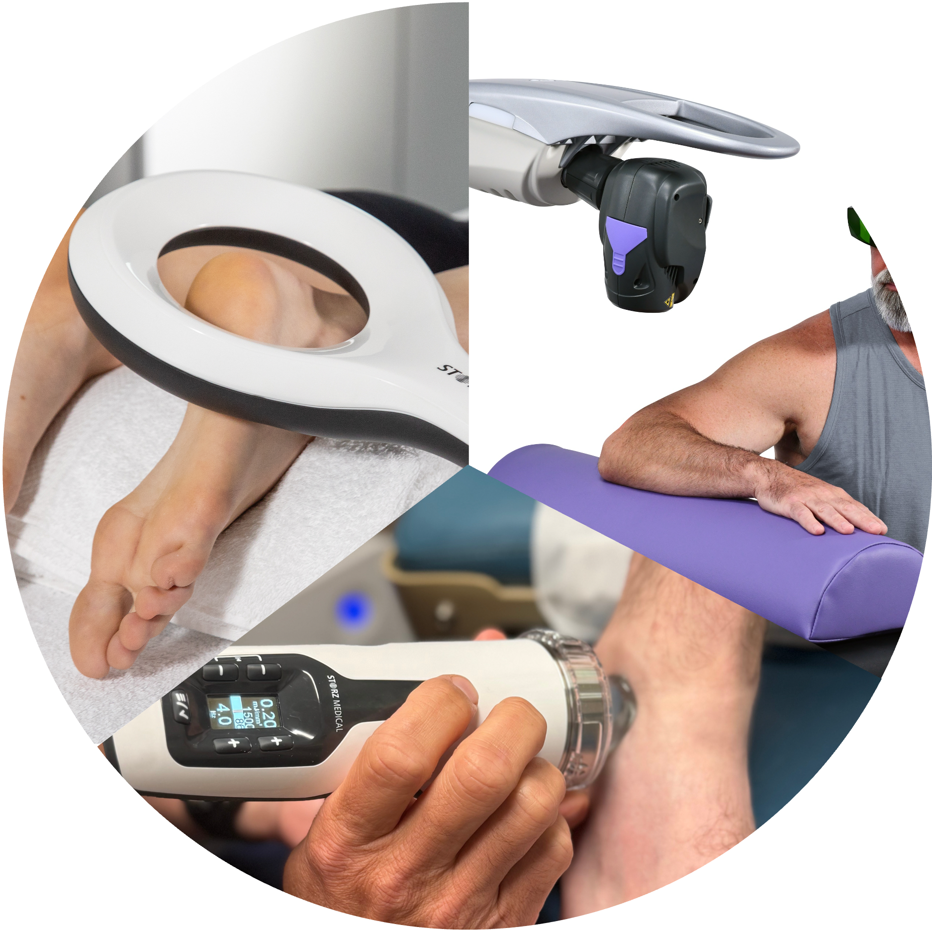 high-intensity laser, electromagnet, and extracorporeal shockwave therapy