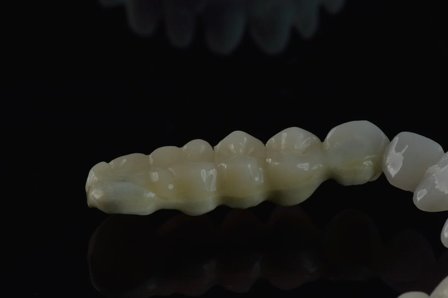 ➡️Mosty z pmma nie wytrzymują okresu gojenia pacjenta?
➡️W pracach z tlenku cyrkonu mosty z dowieszkami i długimi przęsłami nie wytrzymują sił żucia?

Na każdą z tych sytuacji mamy rozwiązanie - wzmocniony most🦾 Wykonujemy metalowe oraz polimerowe s