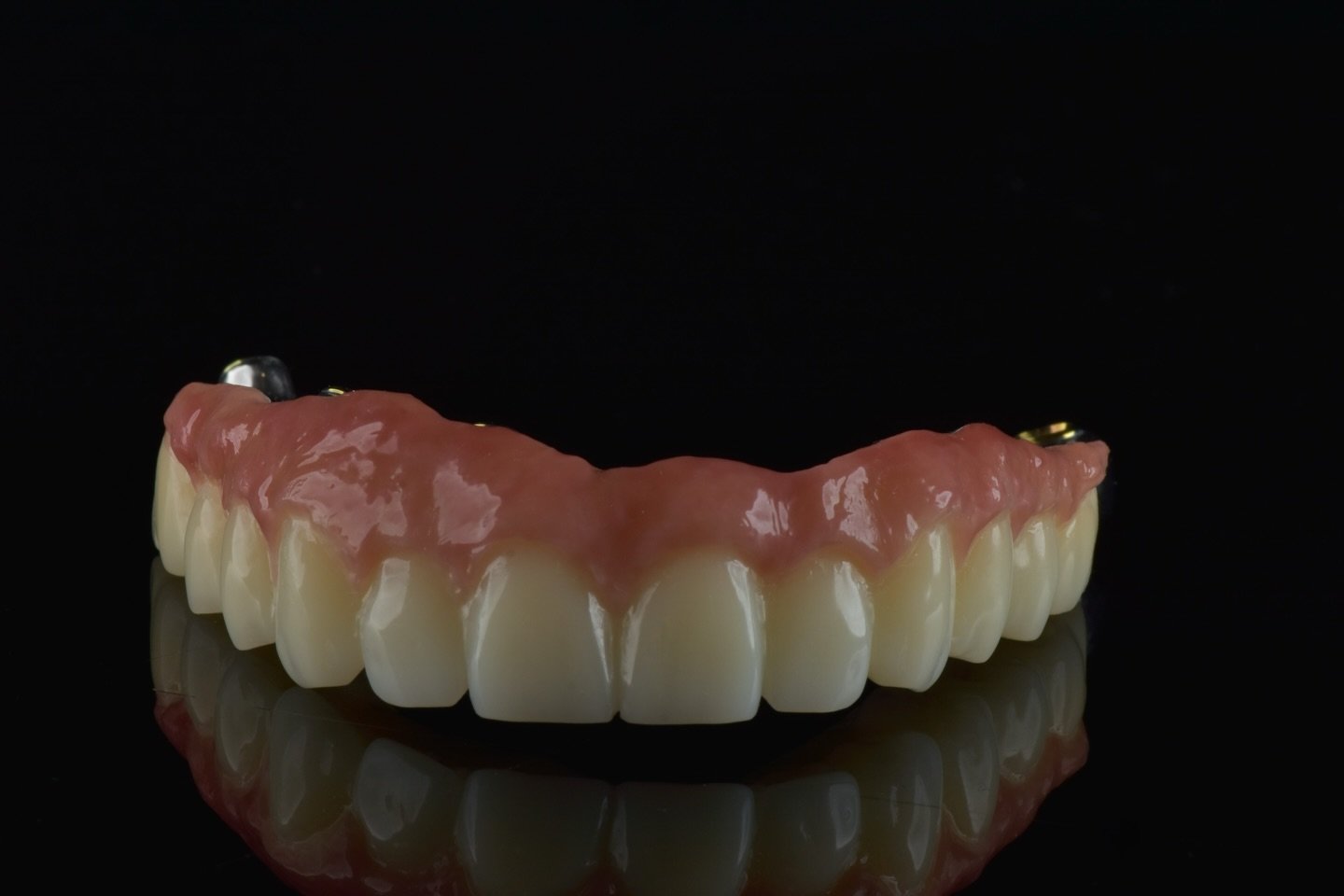 Potrzebujesz pracy dla pacjenta, kt&oacute;ry ma mniejszy budżet, ale trzeba go zaopatrzyć w most all on X? Tu z pomocą przychodzą materiały tymczasowe i długoczasowe.

Na zdjęciach praca długoczasowa przykręcana na implantach Roott(widoczne pojedync