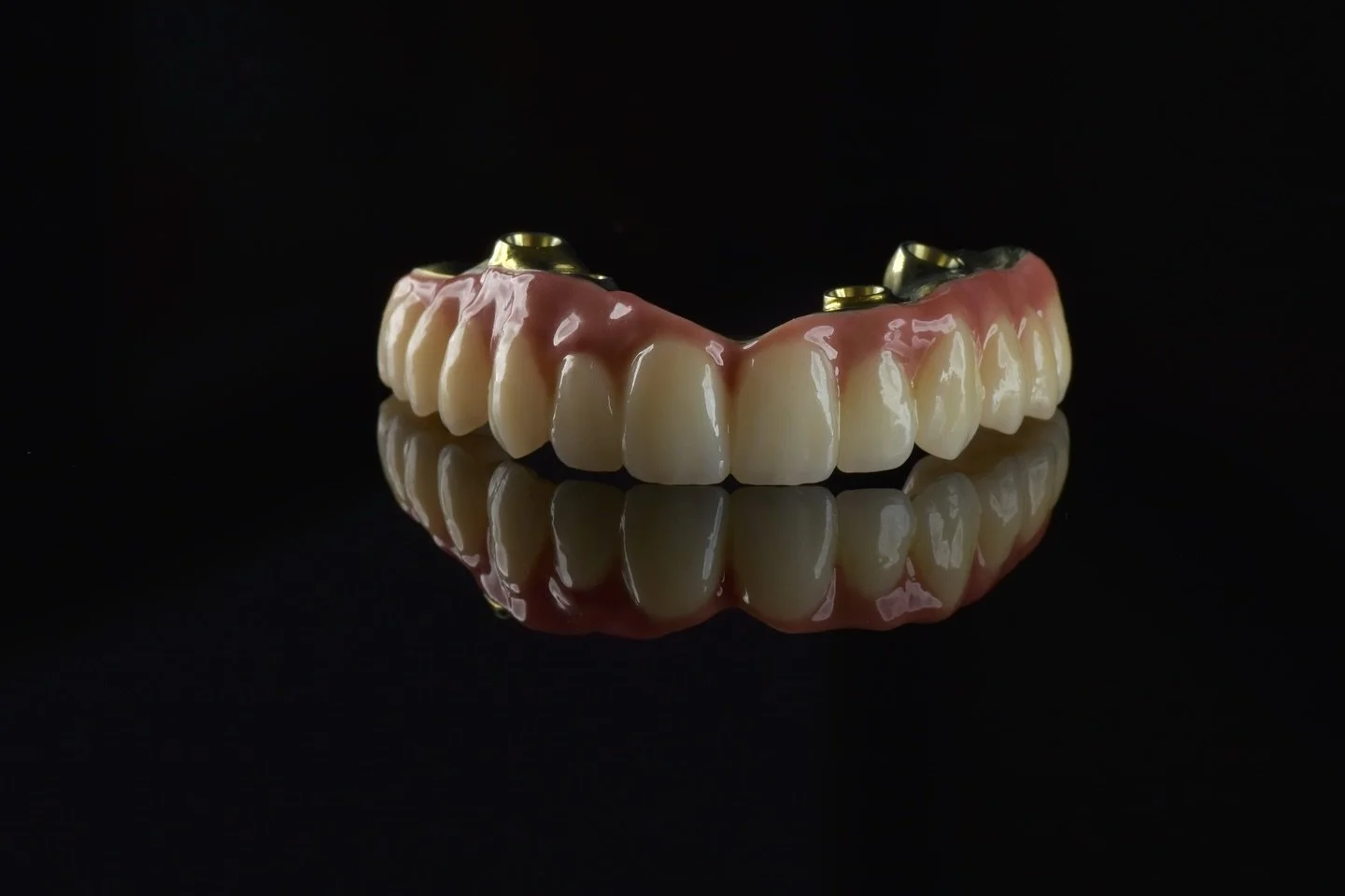 Dzięki dzisiejszym technologiom nie ma rzeczy niemożliwych - pacjentka chciała więcej miejsca na język w okolicach przedtrzonowc&oacute;w. Pozycja multiunit&oacute;w nie pozwalała na redukcję, kątowh multiunit podni&oacute;słby wewnętrzną krawędź w g