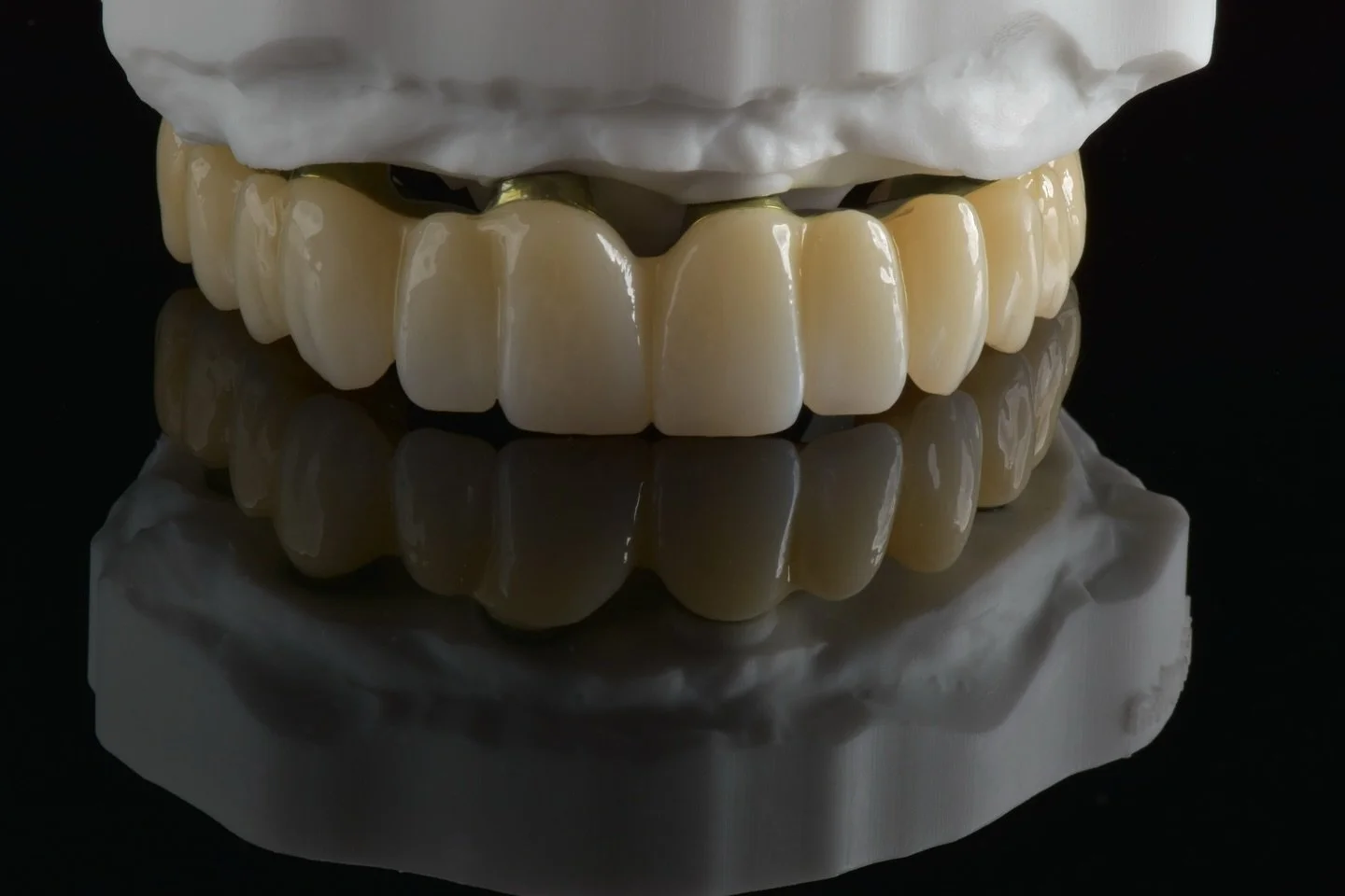 Skomplikowane warunki? Z odpowiednim wsparciem rzeczy pozornie niemożliwe stają się wykonalne😎
Dzisiaj przedstawiamy jedną z niedawno wykonanych prac all on 6. Problem polegał na tym, że musieliśmy wykonać przekierowanie kanału śruby , ale producent