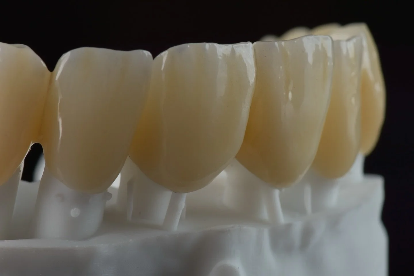 Zęby wyglądające jak żywe i jednocześnie mogące służyć długie lata? Dzisiejsze materiały, z pomocą artystycznego poczucia estetyki naszego zespołu pozwalają na uzyskanie trwałych, odpornych na odpryski i awarie uzupełnień, kt&oacute;re jednocześnie m