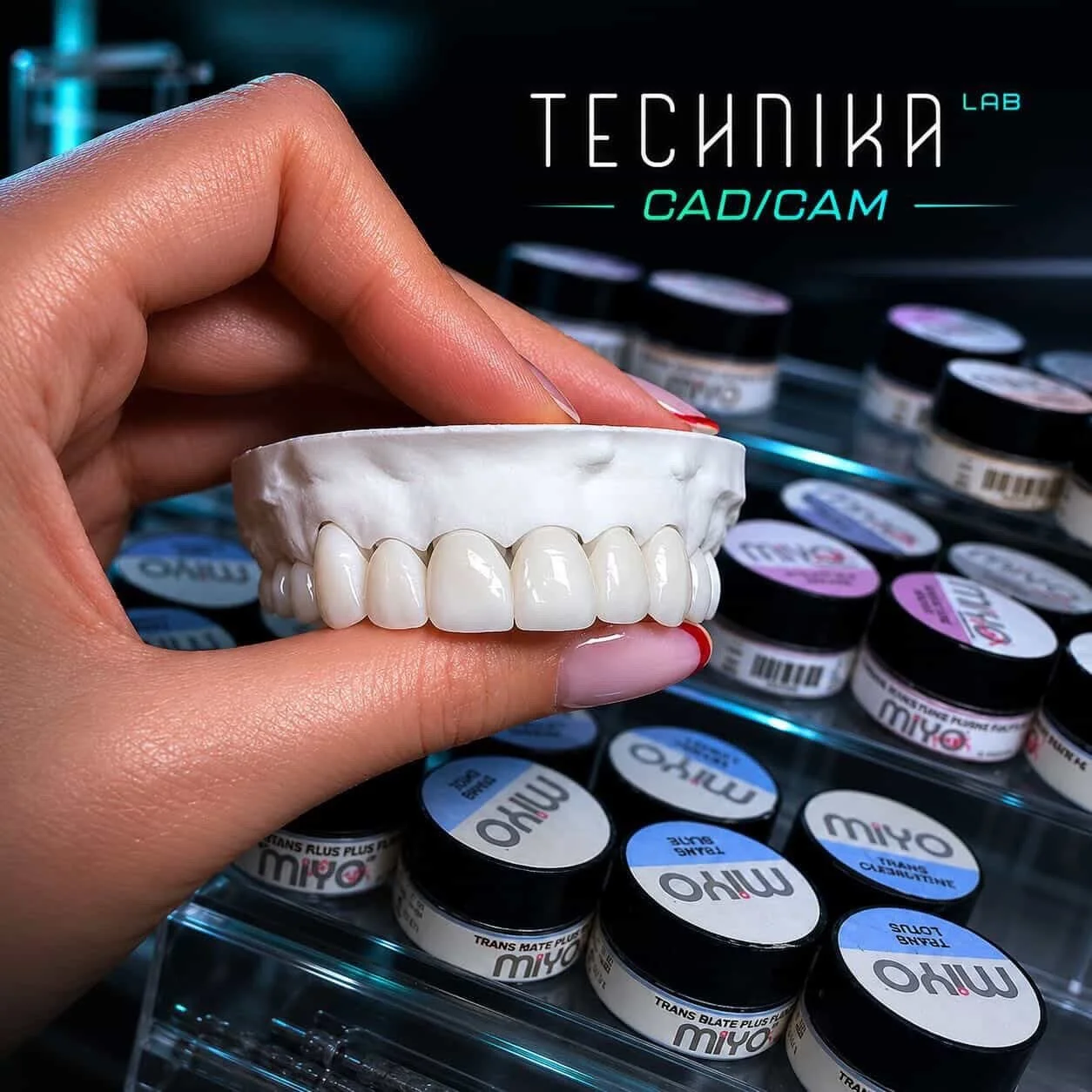 W Technikalab wierzymy, że idealny uśmiech nie ma jednego schematu ✨

Nie każdy pacjent marzy o mocnej charakteryzacji, bardzo naturalnych translucencjach czy instagramowym efekcie.
I to jest całkowicie okej.

Naszą rolą nie jest tworzyć uśmiechy pod