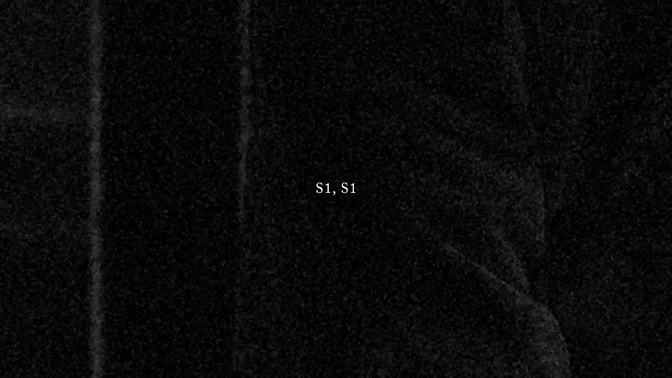 23304_S1_Project Cover.gif