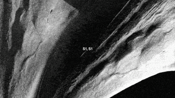 S1_002-ezgif.com-optimize.gif