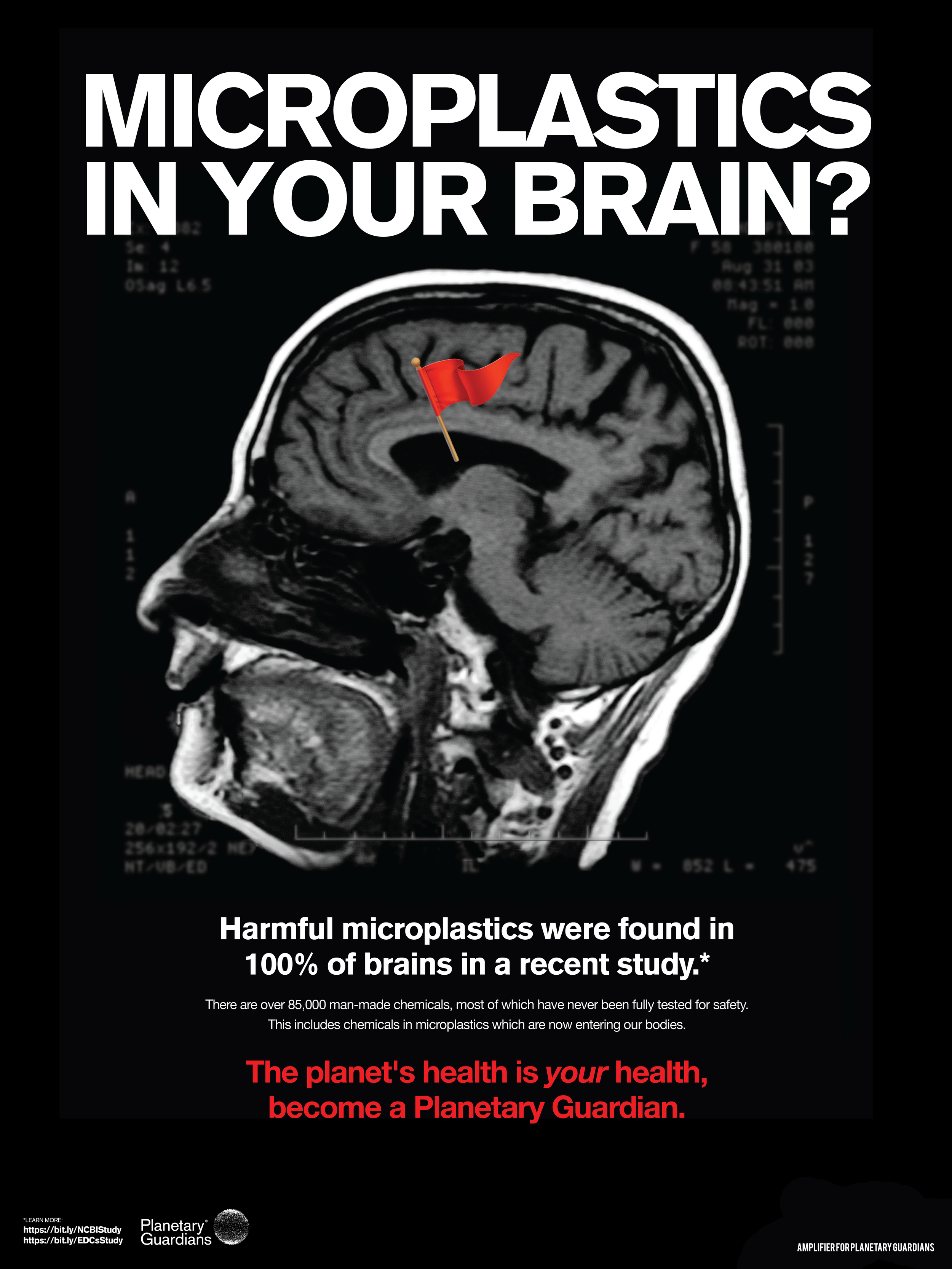 AMPLIFIER_PG_Xrays_BrainDownload.png