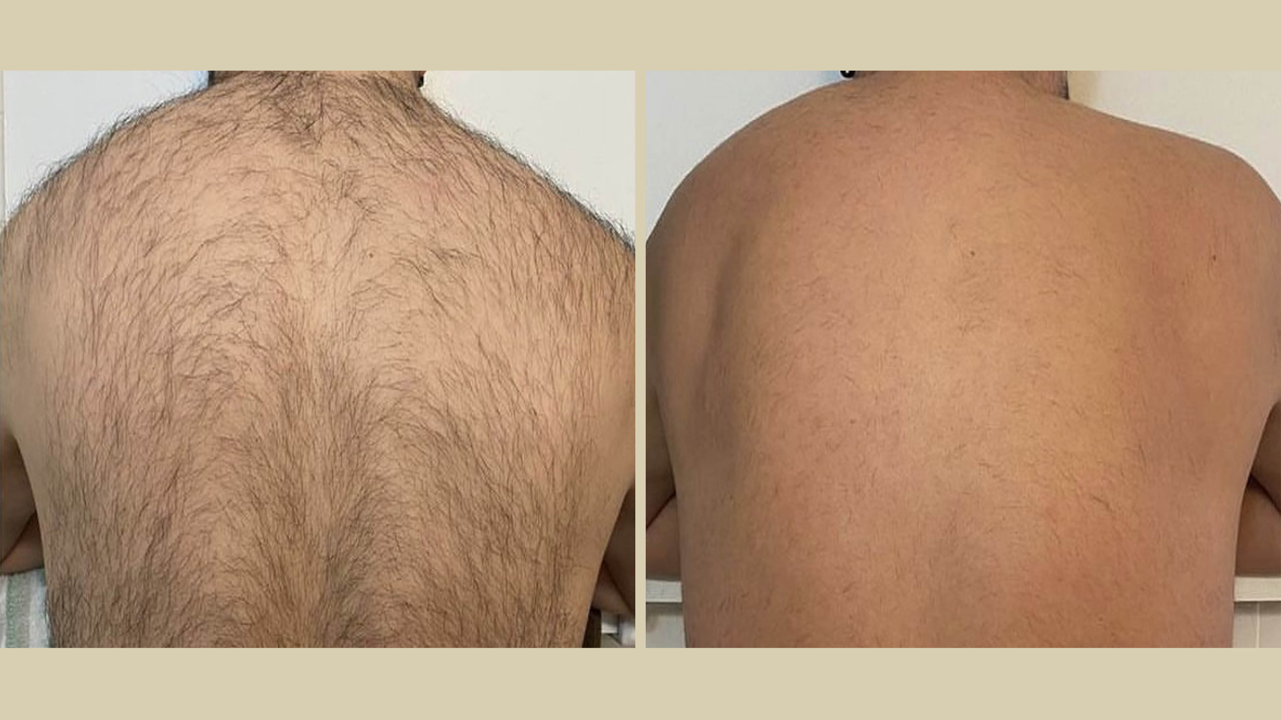 Clarity II B&A - 4T.png