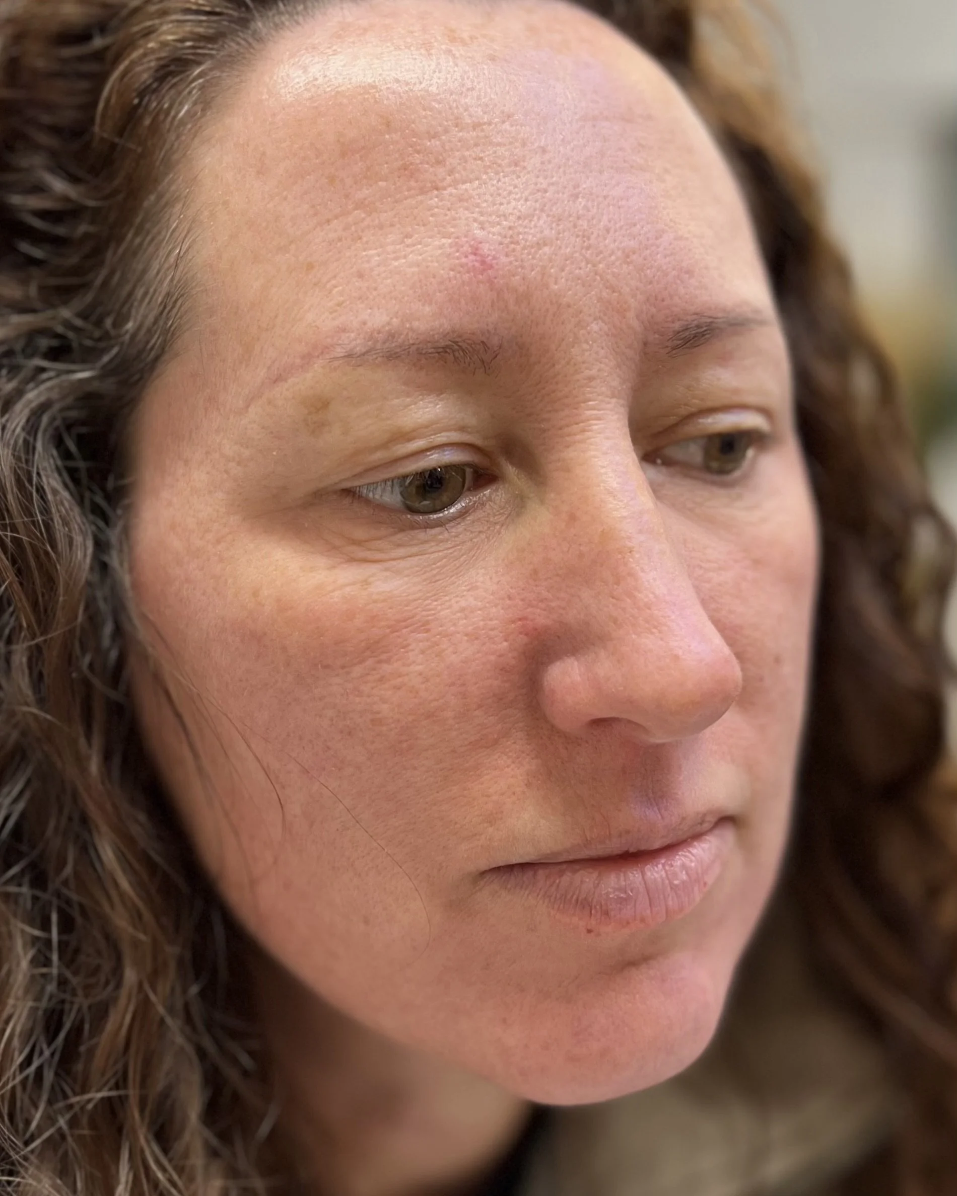 Before picture showing the faded laser removed previous brow artists work, my clients wanted to start from scratch so we could have a best final result with nano brows #beforeshot #sideangle #naturalbrows #consultation #radstock #somersetbrows #pmu #