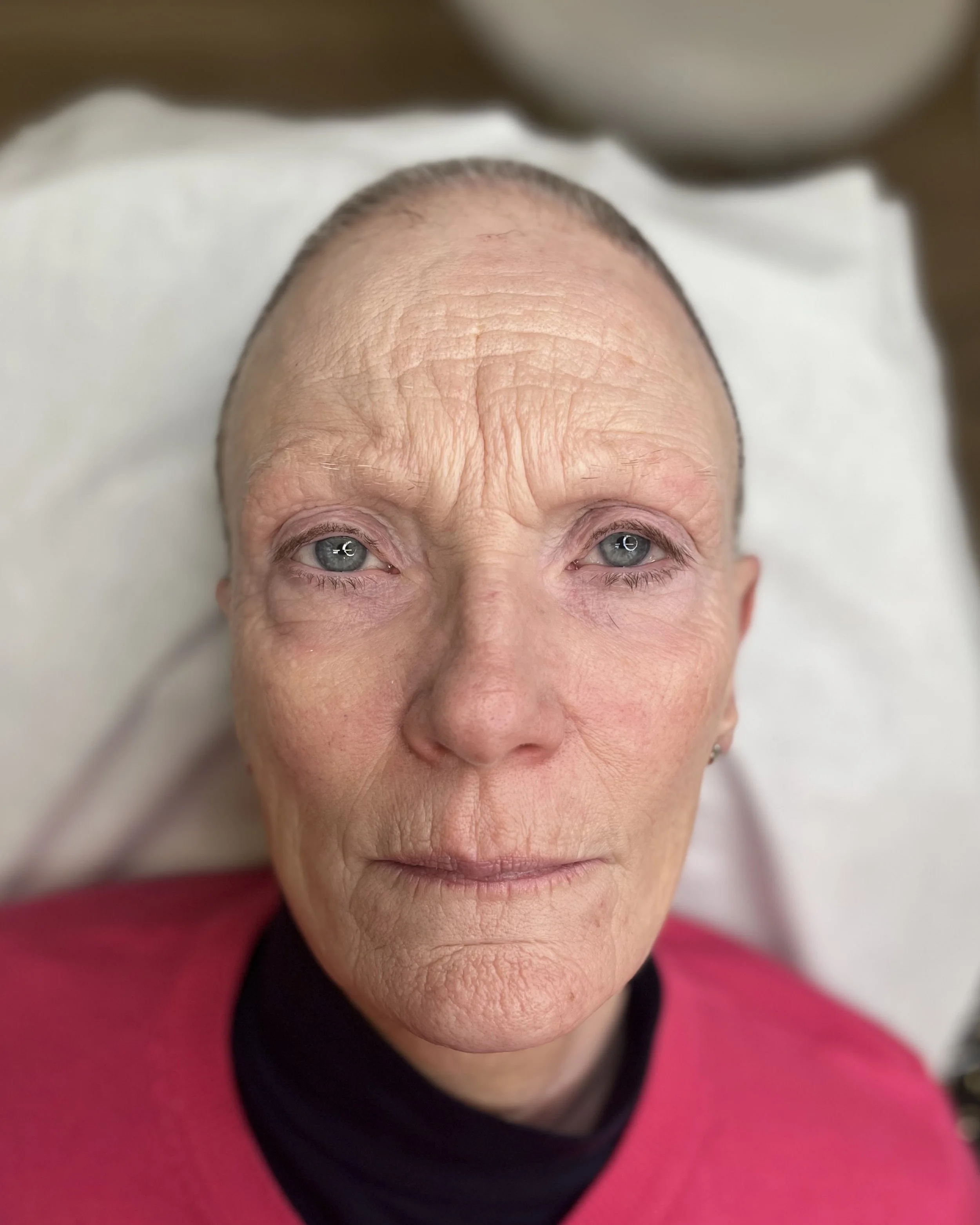 Before photo of my beautiful client who suffers with alopecia #beforephoto #nano #bristol #permanent #makeup