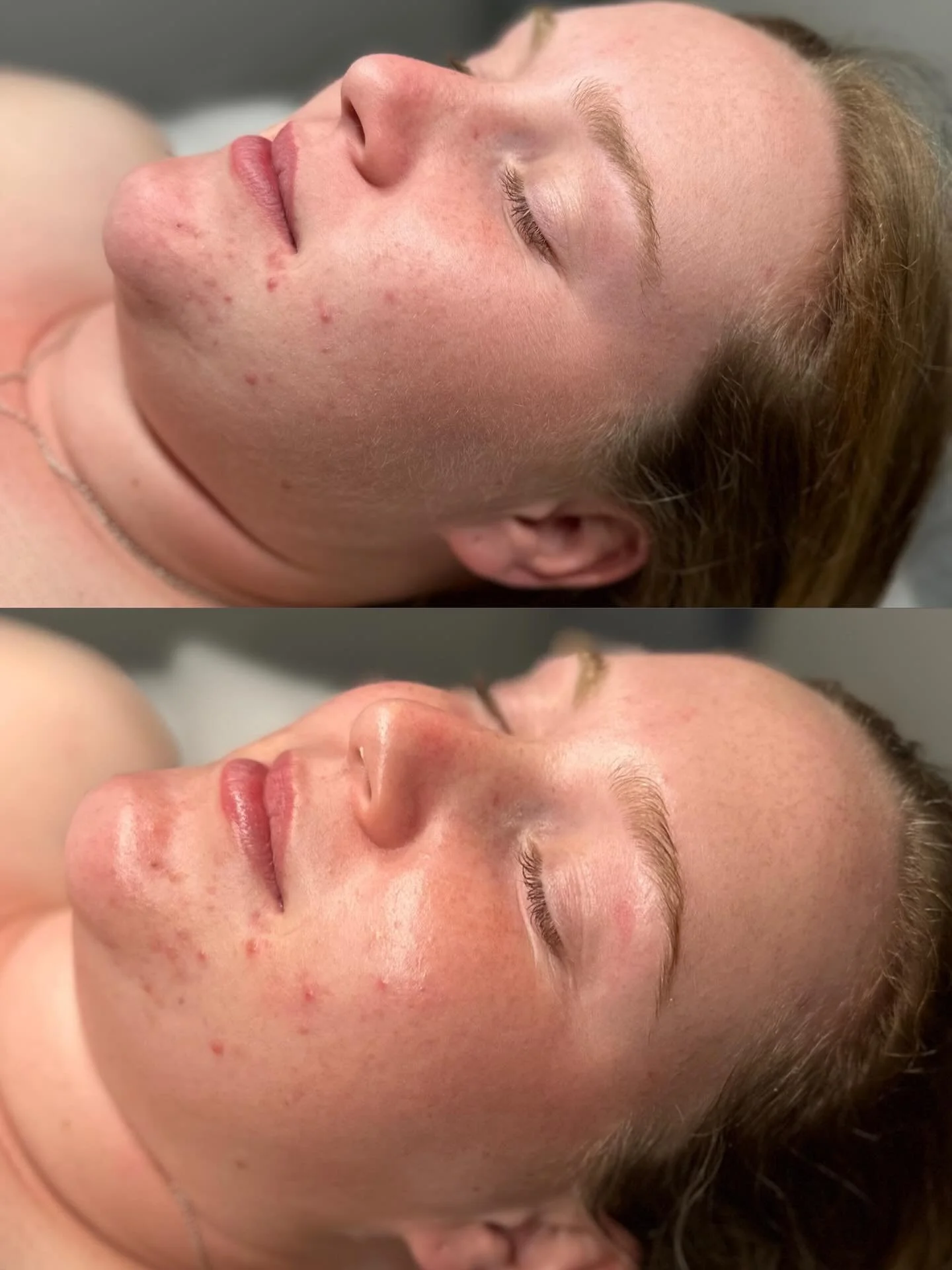 Hydrate &amp; repair - Dermaplane &amp; @liraclinical skincare @therapybykrystal