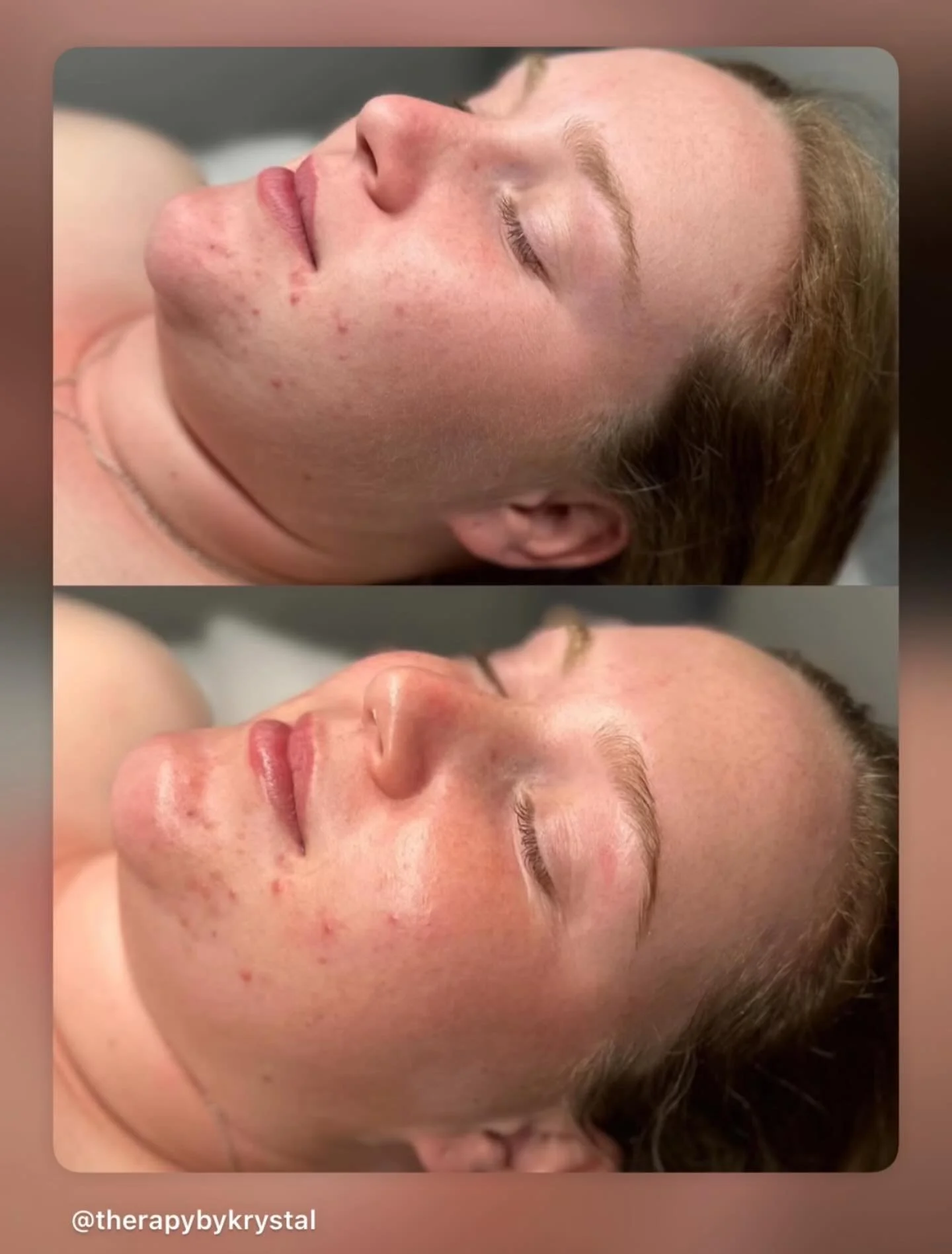 &ldquo;Every skin journey starts with one decision: to begin.