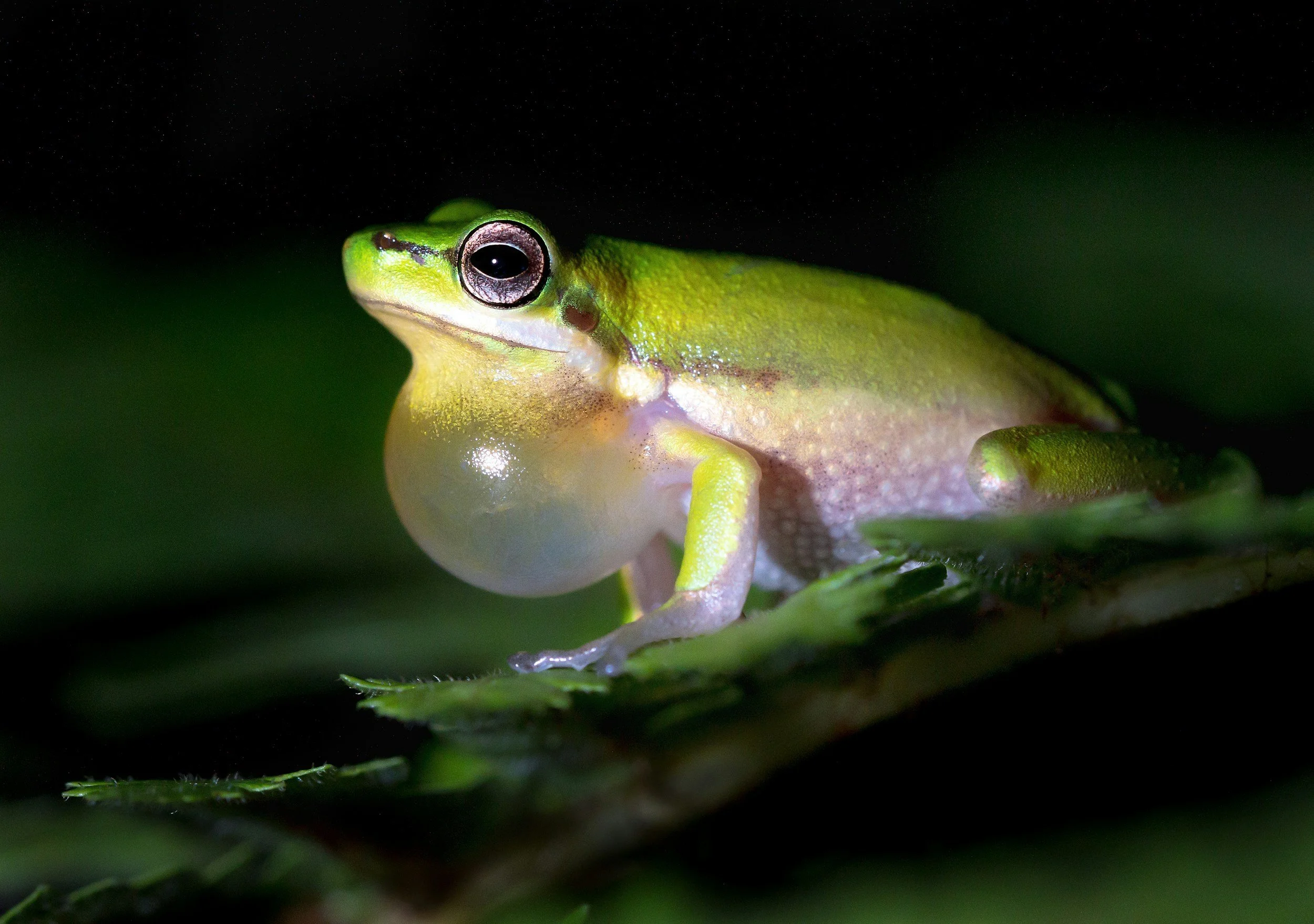 AVNRT is the commonest SVT. Cause of the “frog sign” and feels like your whole body is shaking in time with your heartbeat.
