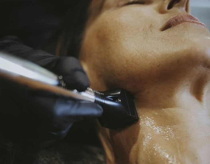 Inmode Forma for Skin tightening in Stouffville