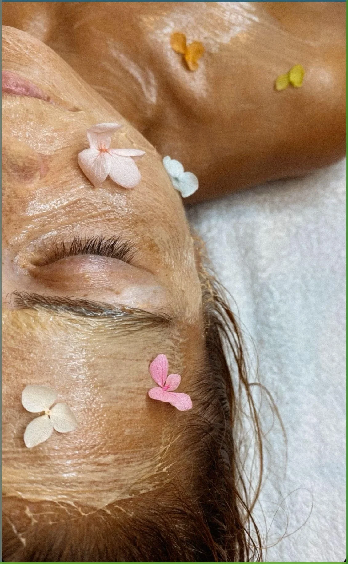 Best Medical Spa Treatments for Glowing Skin Before a Big Event