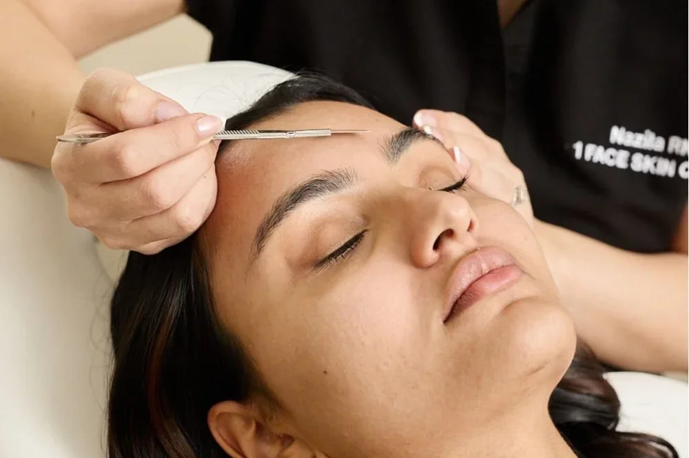 Before &amp; After: What to Expect from Your First Filler Appointment