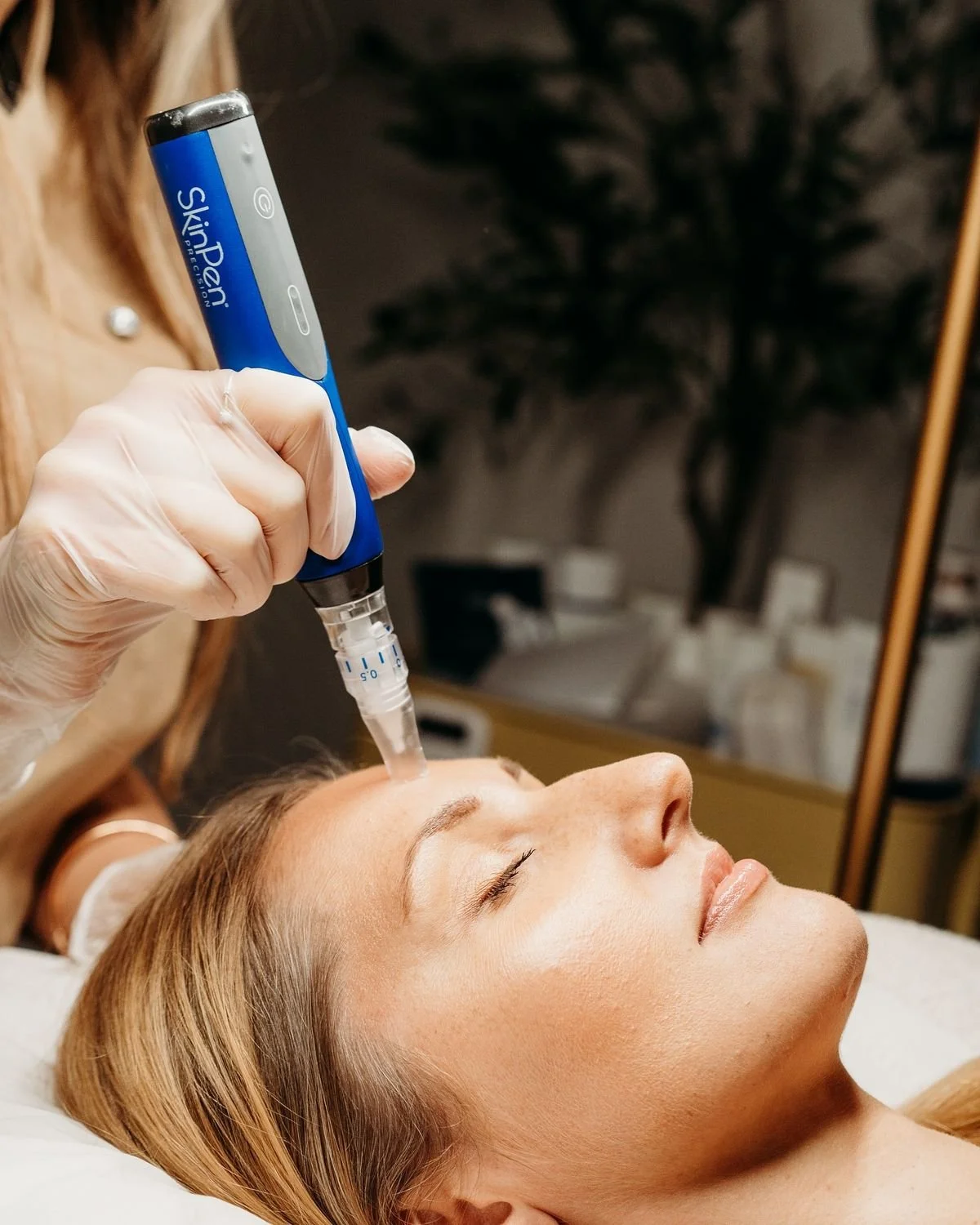 What to Avoid After Microneedling: The Full Aftercare Guide