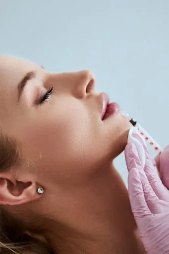 How to Achieve Natural-Looking Lip Filler (Without Overfilling)