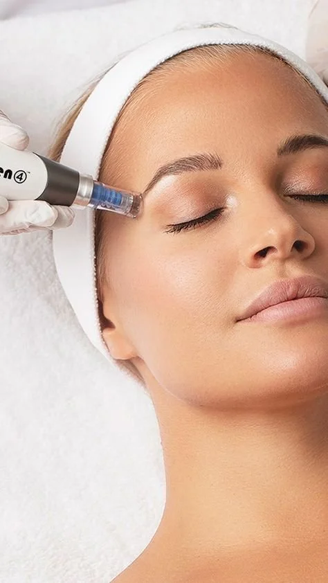 Microneedling vs. RF Microneedling—Which Is Better?