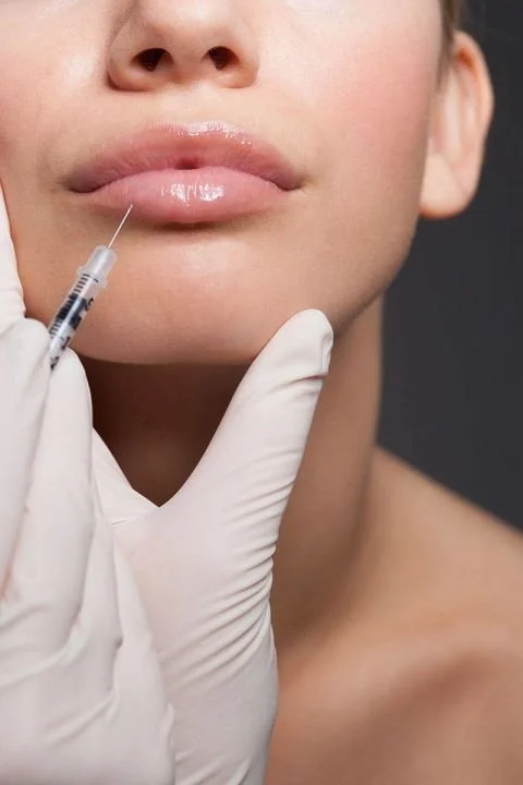 Best Lip Filler Techniques for Subtle Enhancement