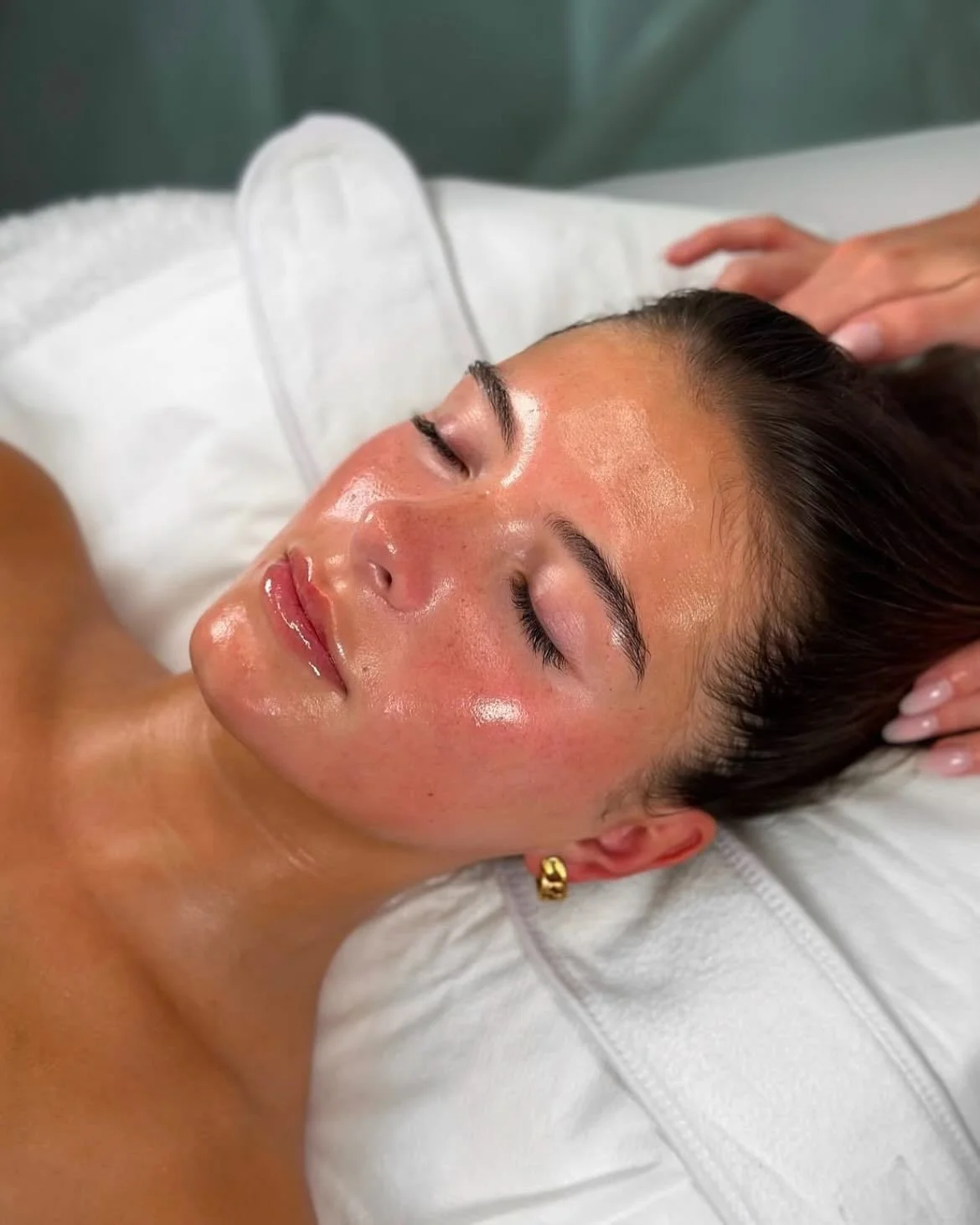 Rosacea Treatments That Actually Work