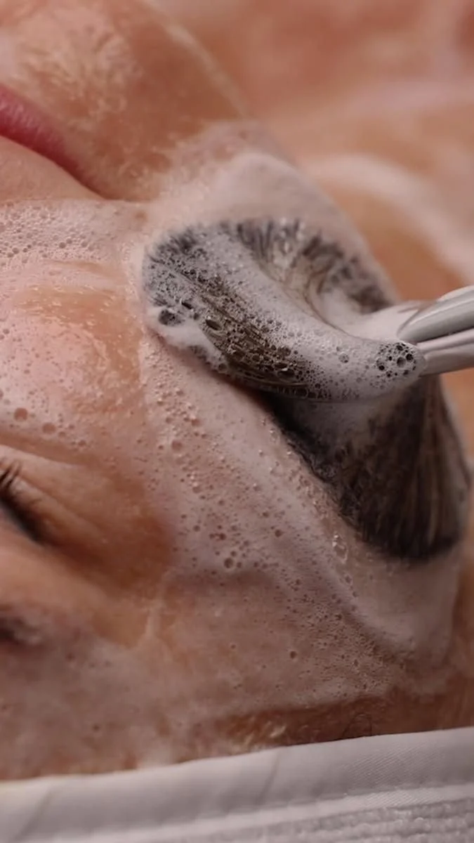Chemical Peel vs. Facial: Which Should You Choose?