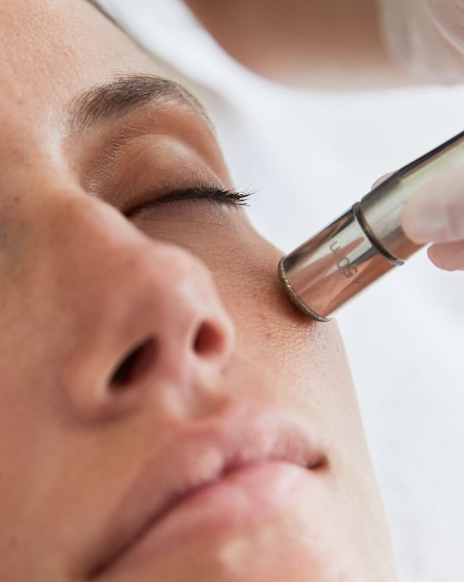 Post-Microdermabrasion Skincare: How to Protect Your Skin