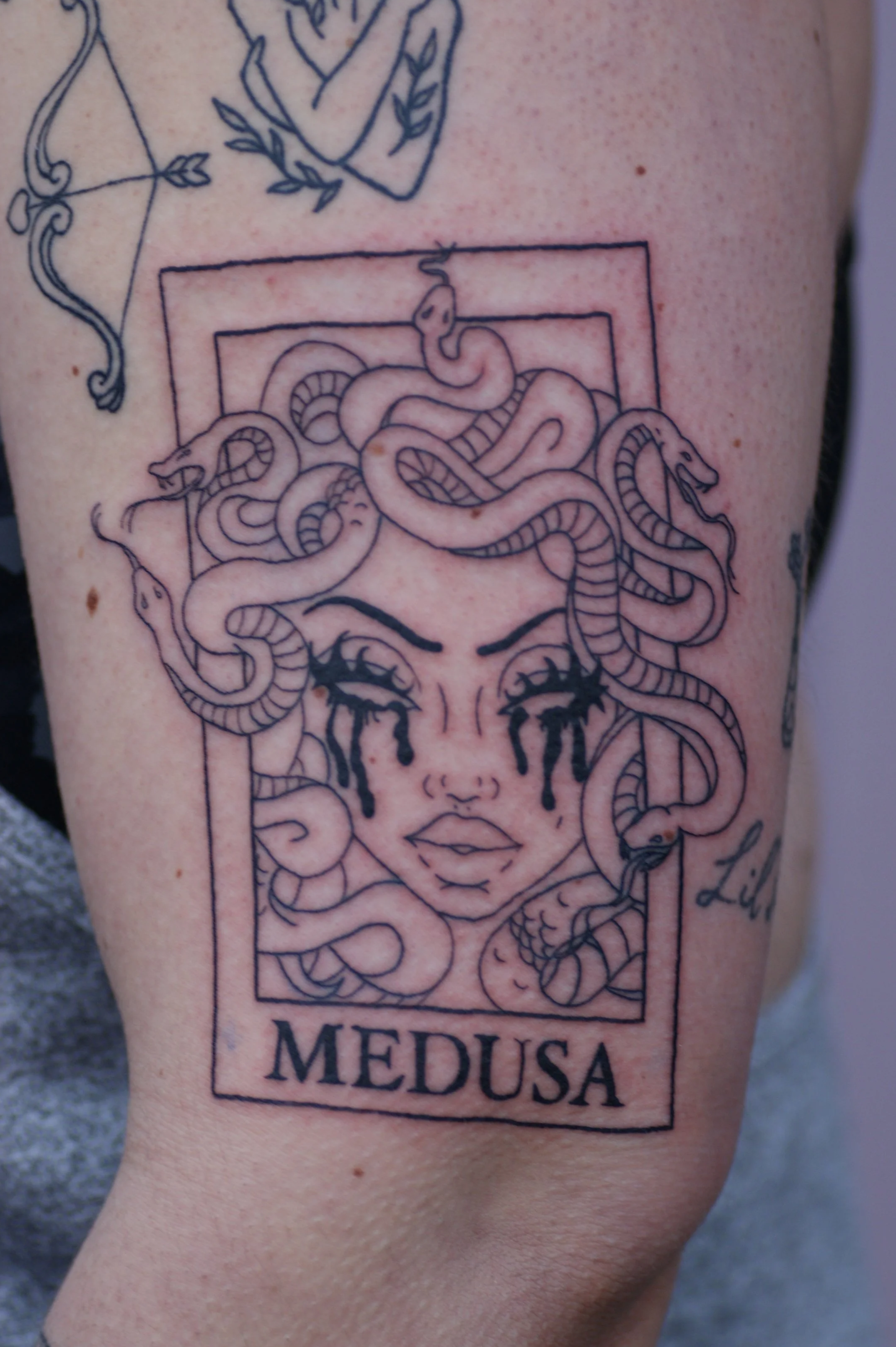 Medusa