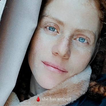 woman with pale skin and blue eyes staring into the camara. freckles are scattered across her face and her lips are pale pink