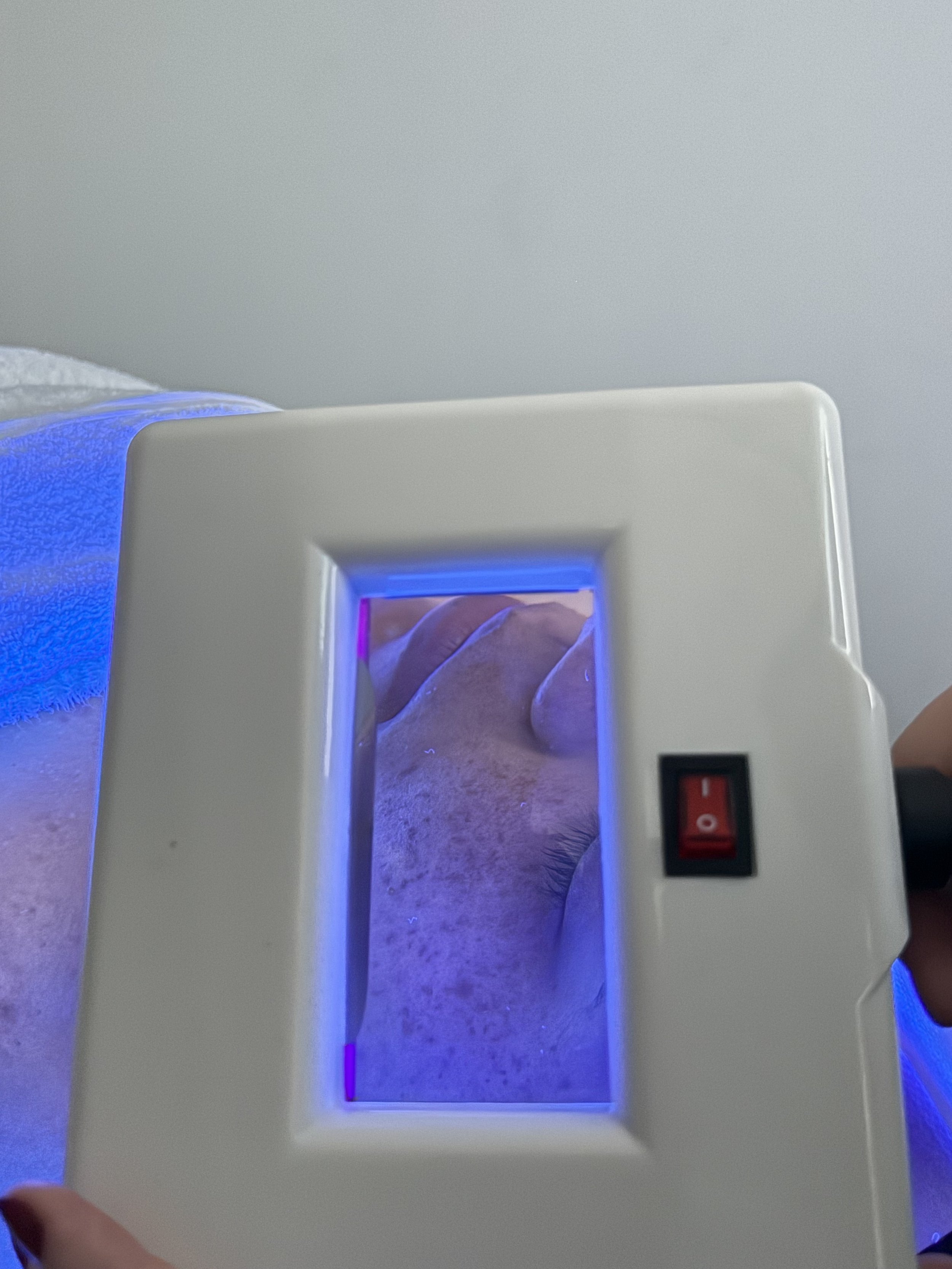 Skin analysis under blue light during a Starter Session consultation