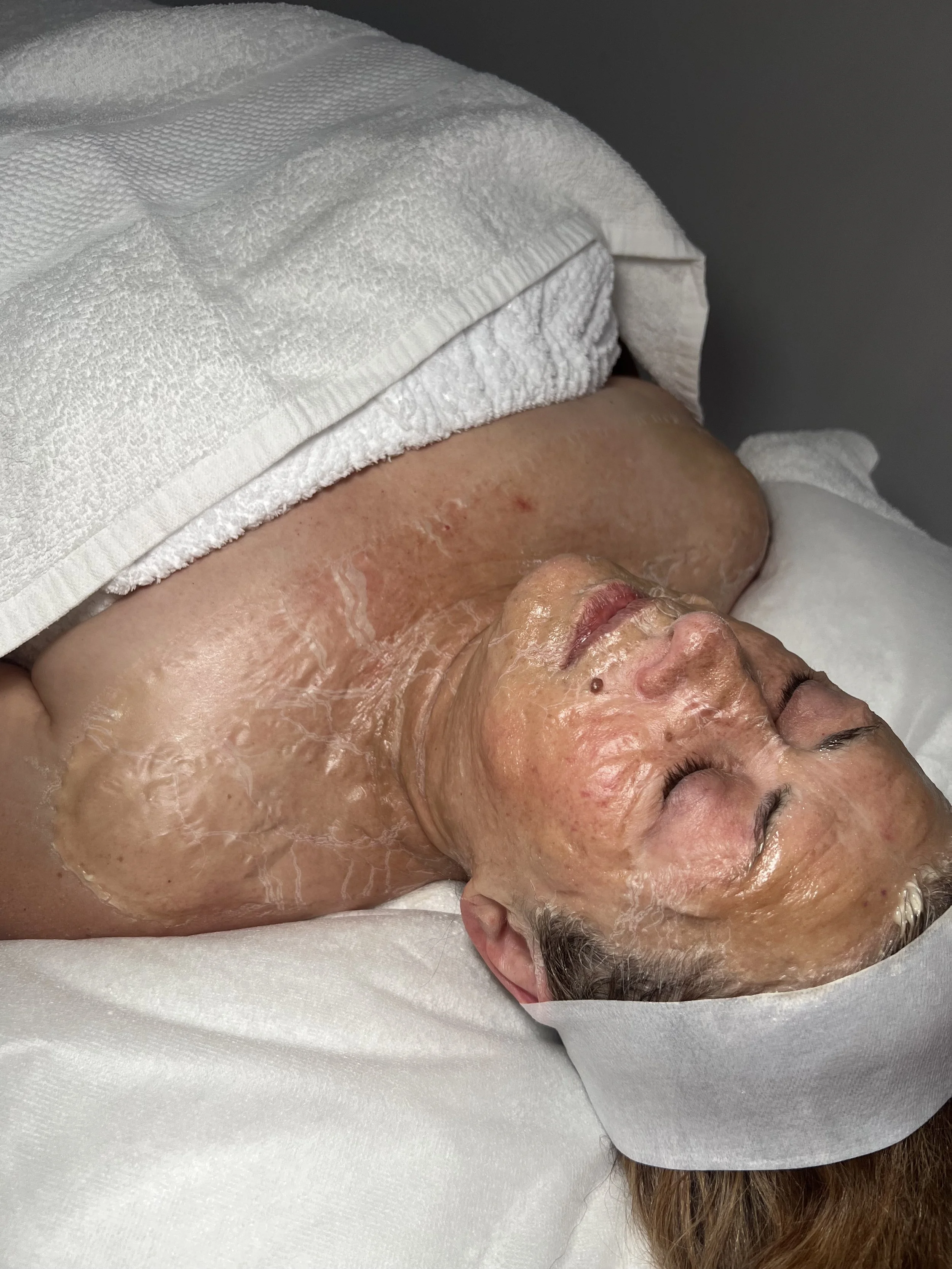 Client with a DMK enzyme treatment mask applied to face and neck