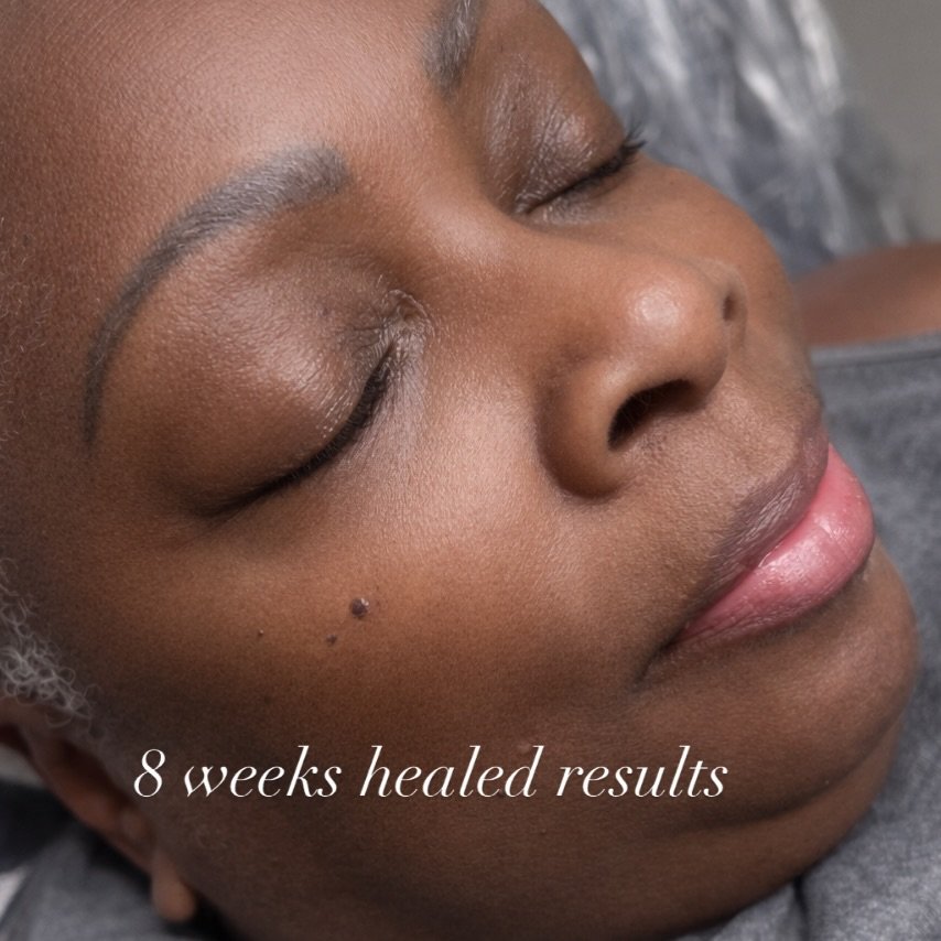 8 weeks ago she came in because her brows had thinned over the years and she didn&rsquo;t know how to shape them anymore.

Nothing dramatic.
Just softer structure and guidance.

We mapped carefully to her bone structure, chose a color that would heal
