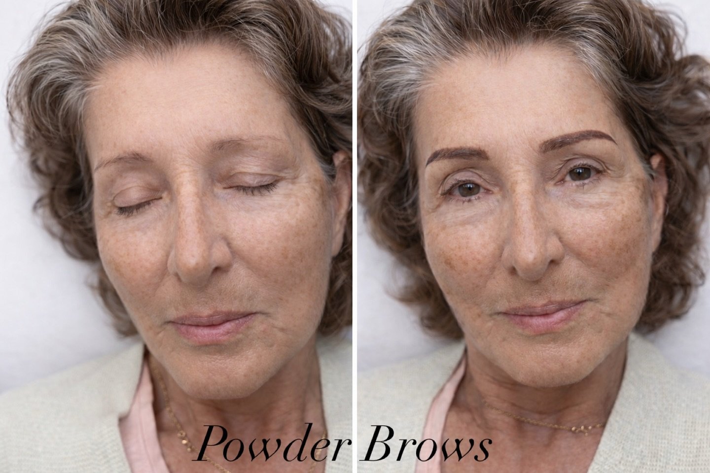 She&rsquo;s in her 70&rsquo;s.

She didn&rsquo;t come in asking for bold or trendy.
She simply said, &ldquo;I&rsquo;d like my brows back.&rdquo;

Over time, they had thinned quietly. Not overnight. Not dramatically. Just enough that her face felt sof