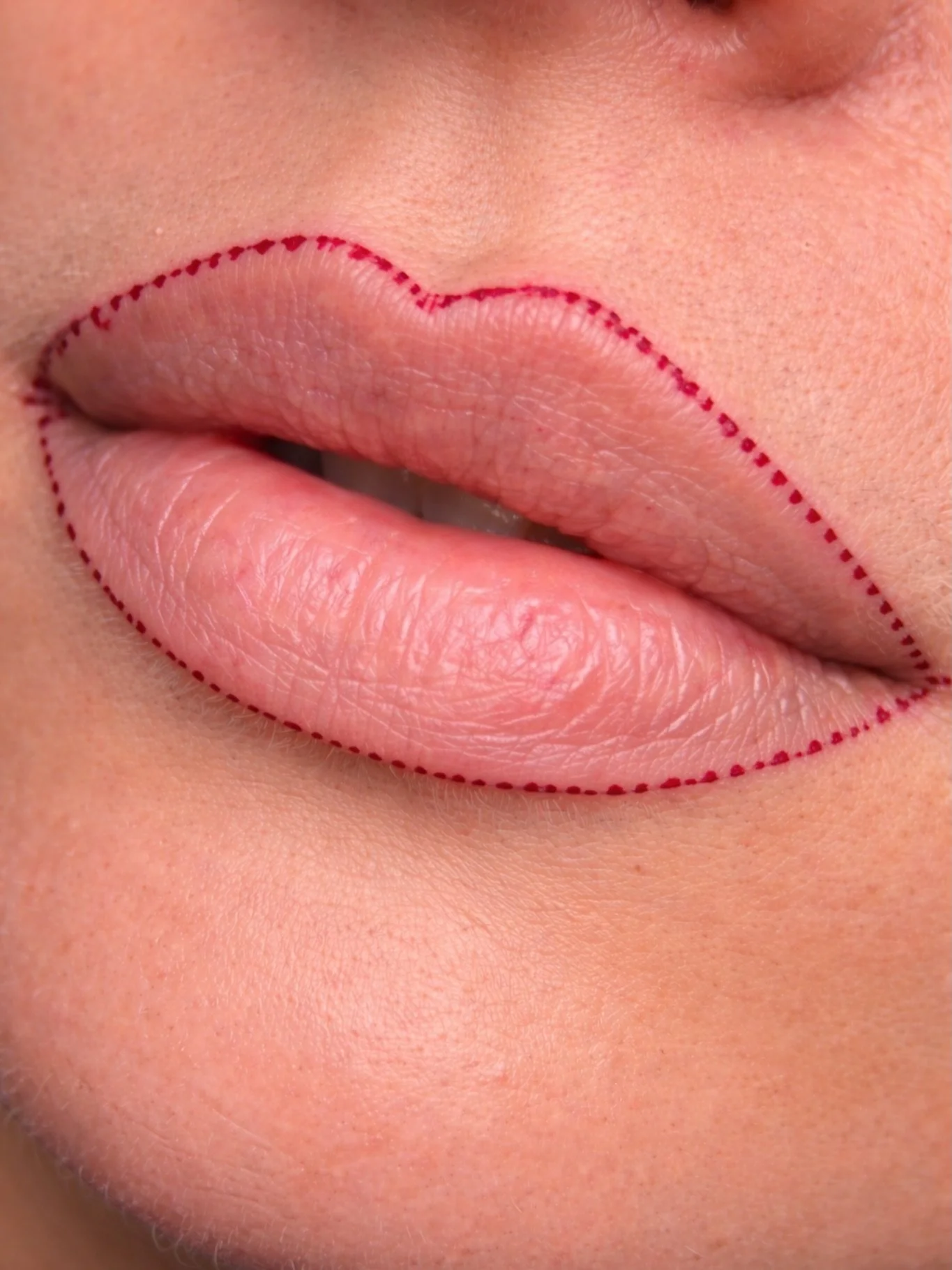 Most people think lip blush starts with pigment.

It doesn&rsquo;t.

It starts with the redraw.

Because lips are rarely perfectly balanced.
One side may sit slightly higher.
The cupid&rsquo;s bow may soften unevenly.
The corners can tilt differently