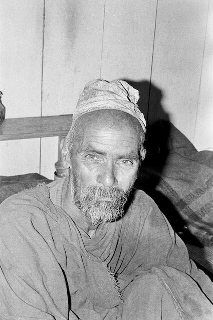 assaulted, leg fractures