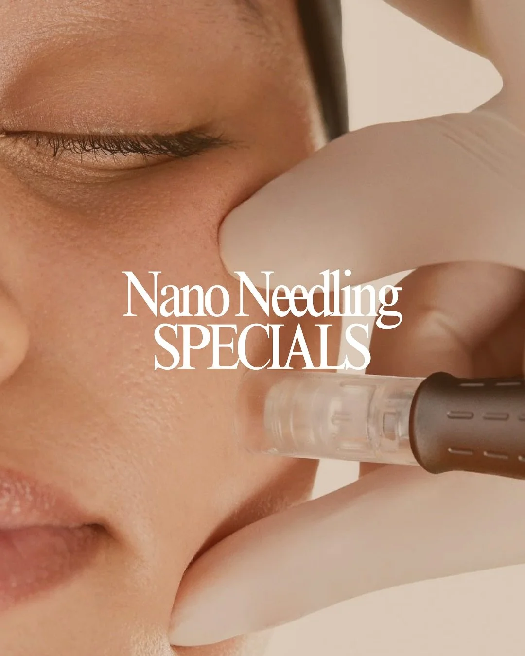 Smooth. Bright. Glowing.

Our Nano Fusion facials are your go-to for fresh, luminous skin.

BOOK NOW!

#NanoFusionFacial #NanoNeedling #SkinRejuvenation #GlowingSkin #HealthySkin #CollagenBoost #SkinTreatment #FacialResults #SkinGoals #NonInvasiveTre
