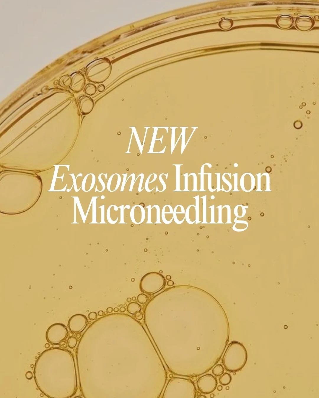 Exosomes are HERE! Boosted results, faster healing, brighter skin. Now added to our microneedling treatments.

Book Now!

#Exosomes #Microneedling #SkinRejuvenation #SkinBoost #AdvancedSkincare #SkinClinic #AestheticsClinic #GlowUp #CollagenBoost #Sk