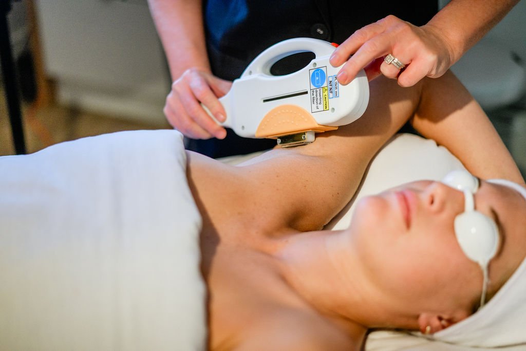 IPL Hair Removal | Permanent Hair Reduction Lennox 20% OFF