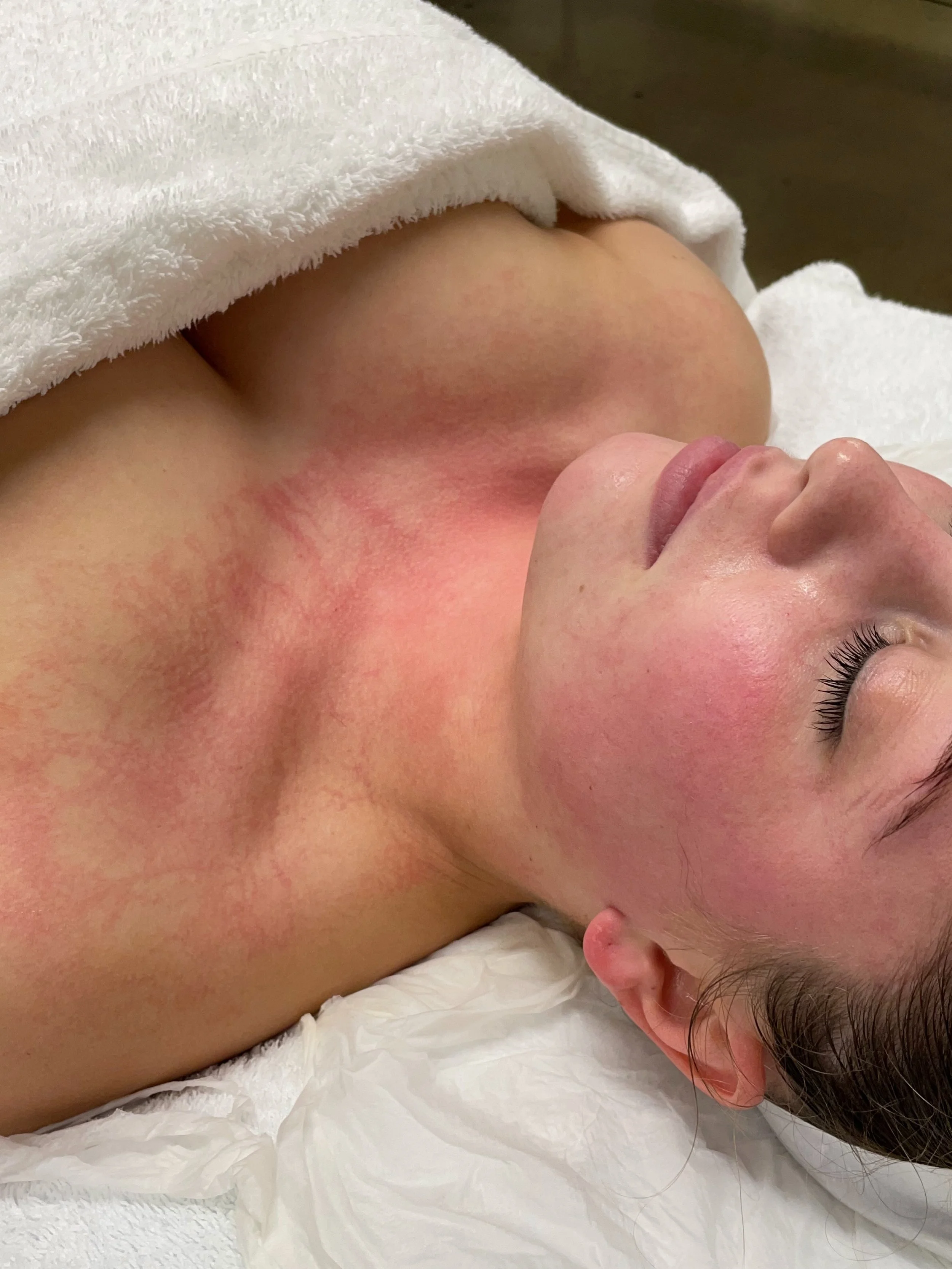 ✨ Ever wondered why your skin looks flushed after a DMK Enzyme Therapy treatment?

This is called the Plasmatic Effect&mdash;a normal response that happens as circulation is stimulated, delivering oxygen and nutrients to the skin. 🤍

Every skin resp