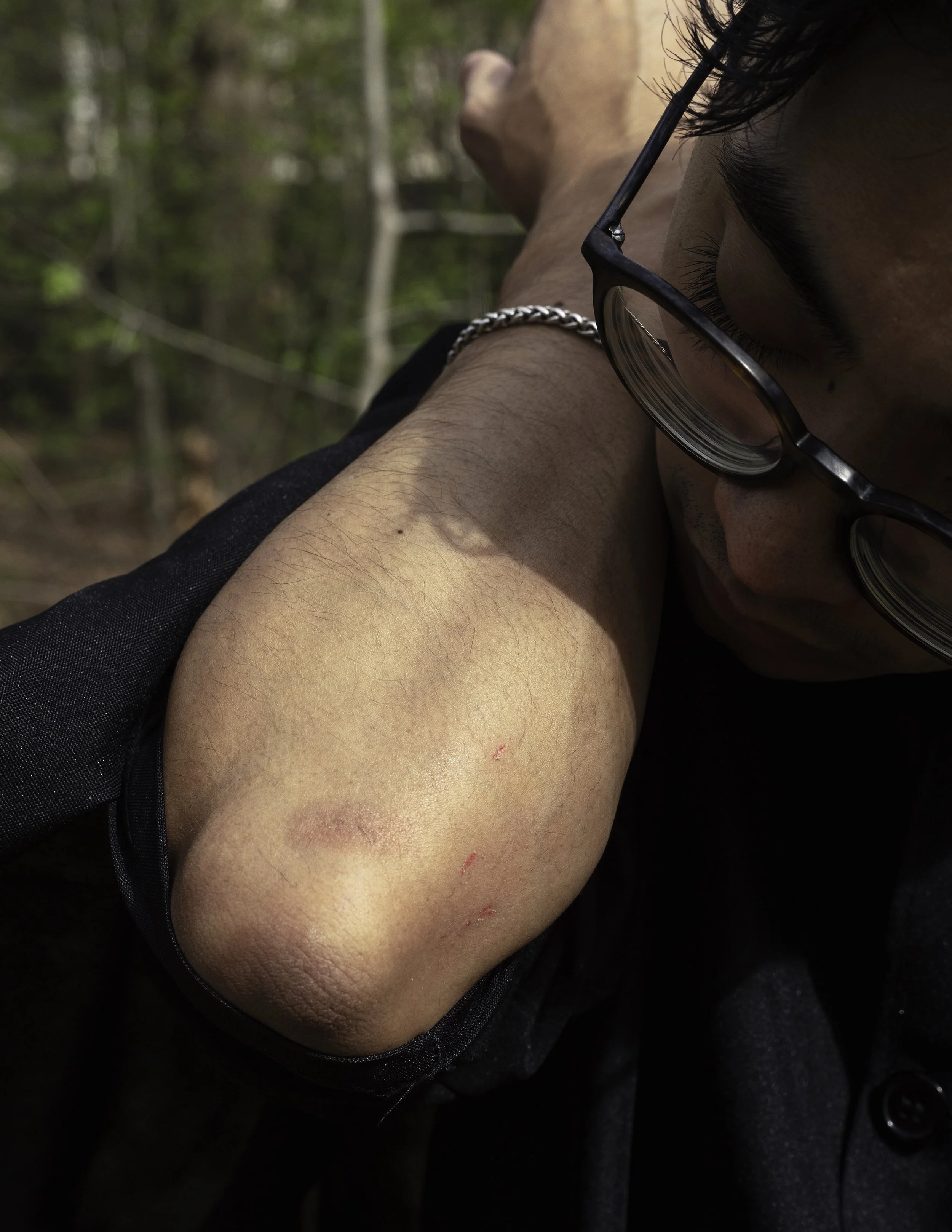 edit injury-Edit.jpg