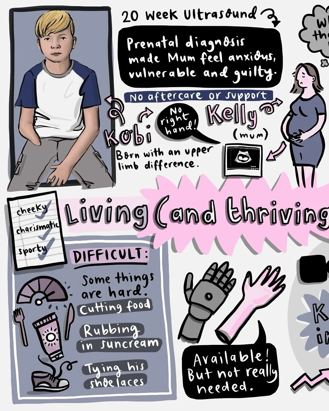 Graphic recording of the @thesendmumclub podcast 'Living (and Thriving) with a Limb Difference'. 
.
This was such a good listen. It was all about @k_o_b_i___s__ 's story and how his brilliant mum, Kelly, coped with the uncertainty she faced when she 