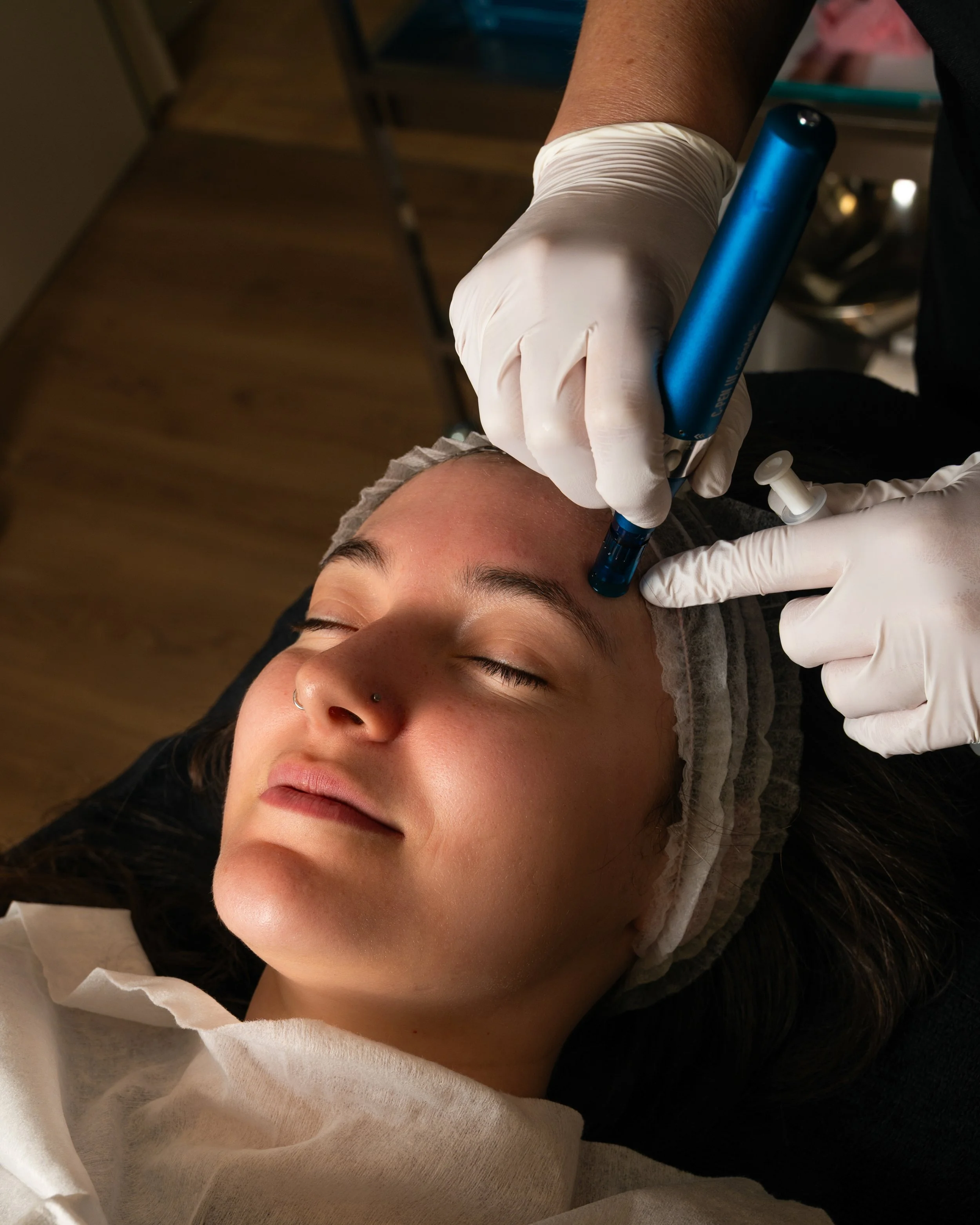 Person receiving a cosmetic or skincare treatment on their face, lying down, with a towel wrapped around their head, and a technician wearing gloves performing the procedure with a blue instrument.