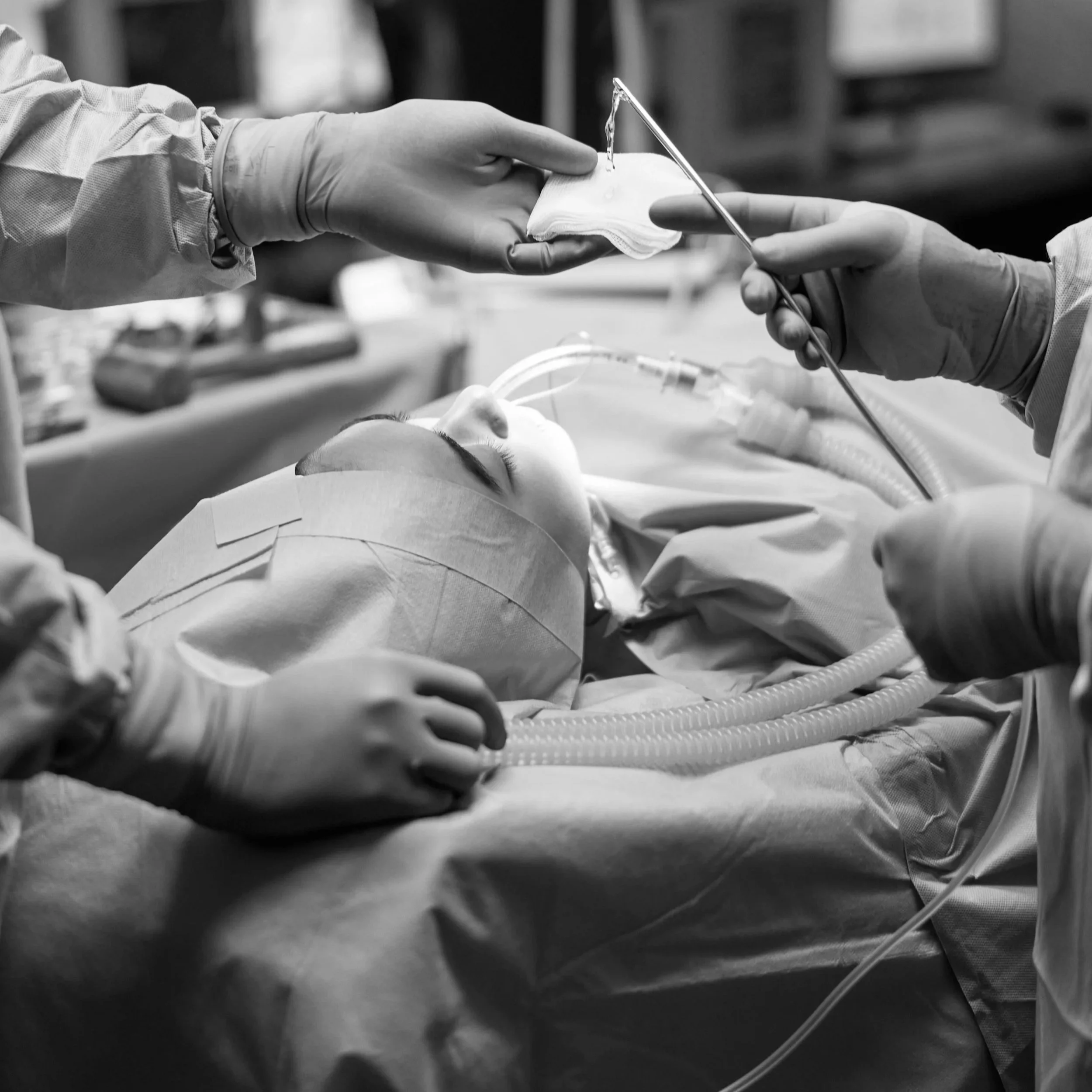 Unilateral Cleft Lip Repair