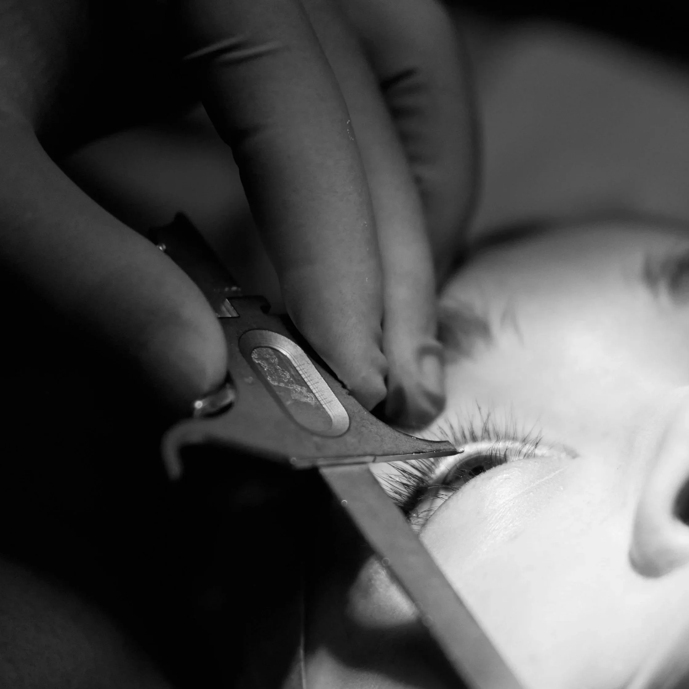 Prevention and Management of Rhinoplasty Complications