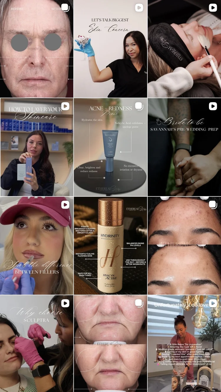 Client feed before Jolie