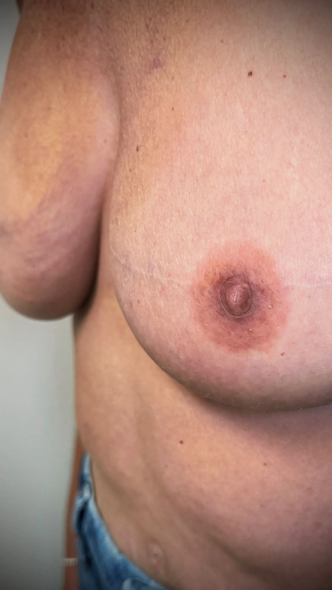 close up 3D areola tattooing post breast reconstruction