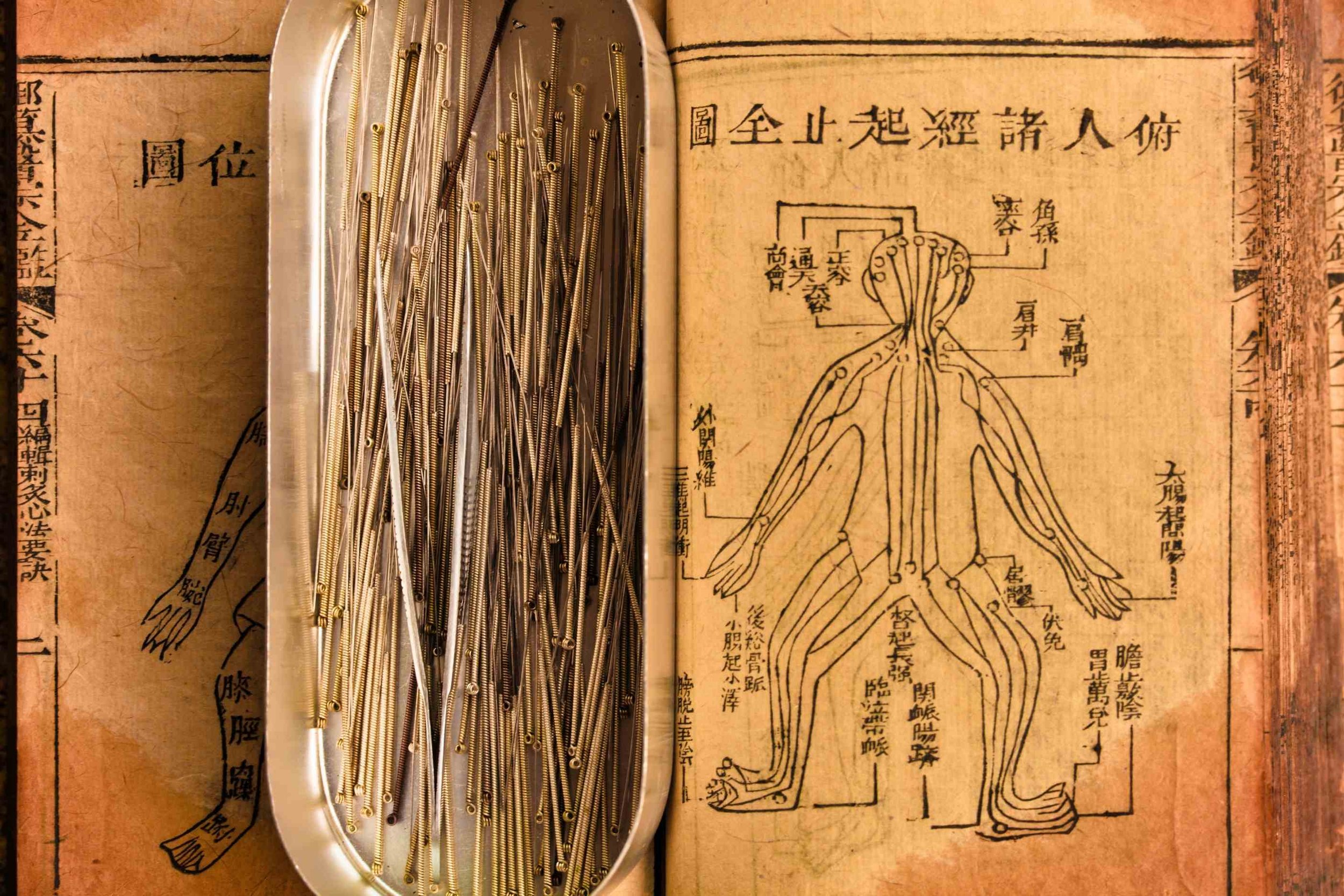 A set of acupuncture needles placed in an oval container on top of a traditional Chinese medical diagram.