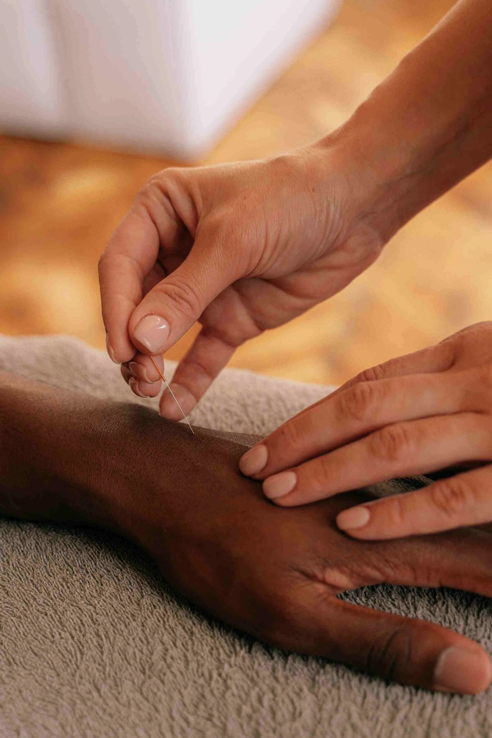 Hannah gently inserting needles into a clients hands